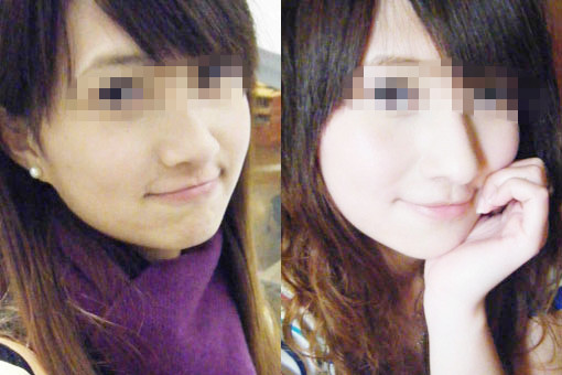 医师解惑美白为什么能美白?