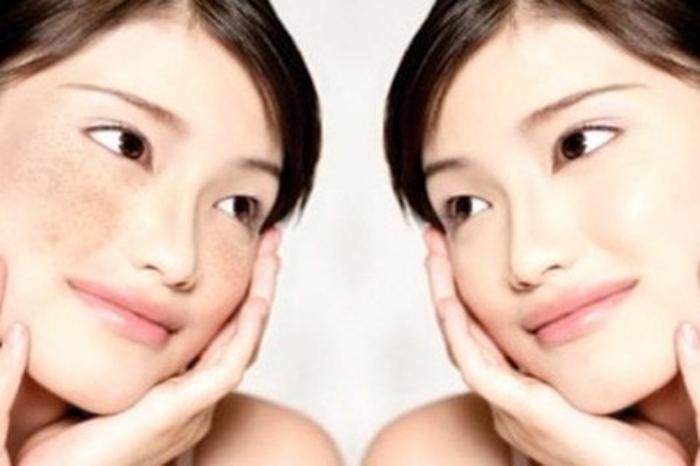 c6祛斑的价格贵吗?